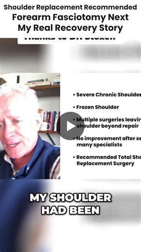 Chronic Exertional Compartment Syndrome Treatment Success Story | Team Doctors Academy posted on the topic | LinkedIn