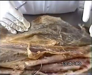 Anatomy Of Anterior And Medial Compartment Of Thigh