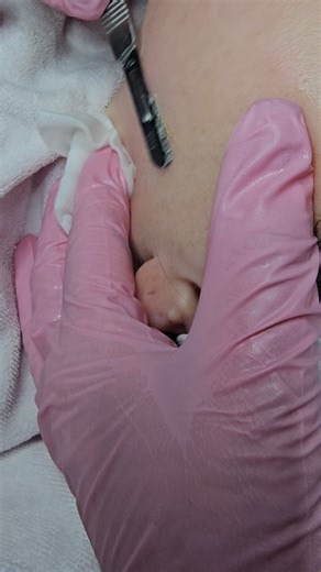 to make beautiful Spa & Salon on Instagram: "What the clients don't see. Clean. Controlled. Professional. Dermaplaning before during and after what professional estheticians do.. #licensedprofessional #dermaplaningasmr #localesthetician"