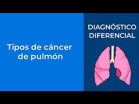 Diagnóstico Diferencial. Tipos de cáncer de pulmón