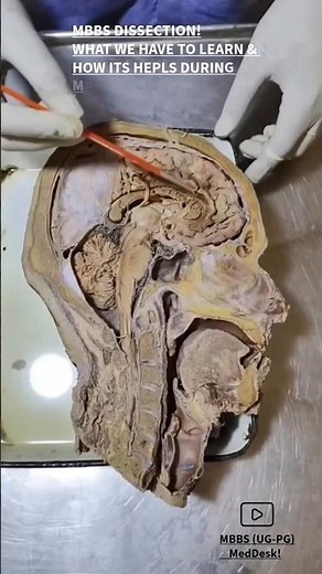 -MBBS , During Dissections what we have to learn and how to Think clinically sub. wise !
