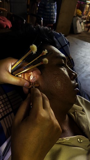 18K views · 119 reactions | https://youtu.be/AYhLC9sfTcM?si=ERk38UVi6BYVMNBu. #ear #reelsviralシfb #reelsfypシ #waxremoval | Tiger | Facebook