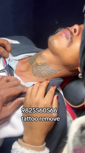Professional Tattoo Removal Services in Bardiya