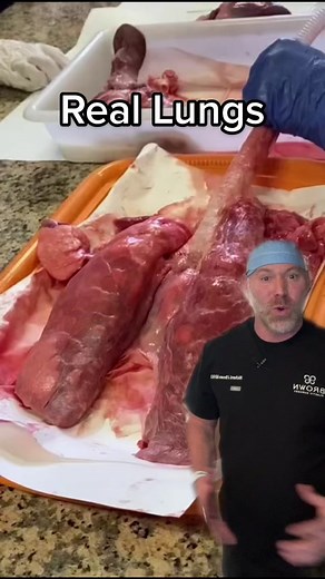 Understanding Lung Anatomy and Function