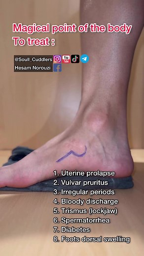 Magical healing point of the body #acupuncture #Reflexology #acupressure #healing | Hesam Norouzi