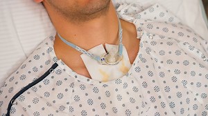 Suctioning Procedure on Patient