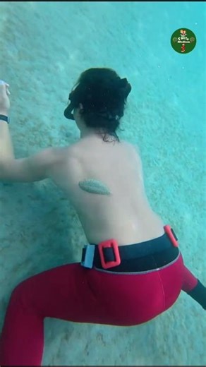 Never Make This Mistake When This Thing Get Stuck On Your Body #shorts #ytshorts