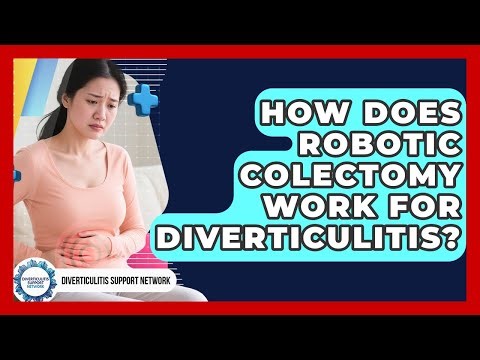 How Does Robotic Colectomy Work For Diverticulitis? - Diverticulitis Support Network