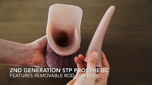 2nd Generation STP Prosthetic