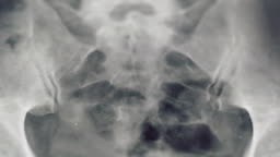 X-ray cervical spine