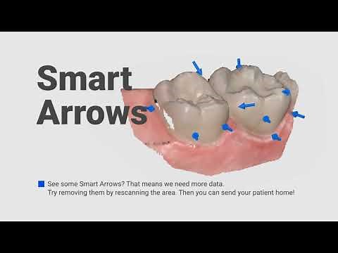Medit i700 | Better for Patients, Easier for Dentists | Smart Software | Smart Arrows