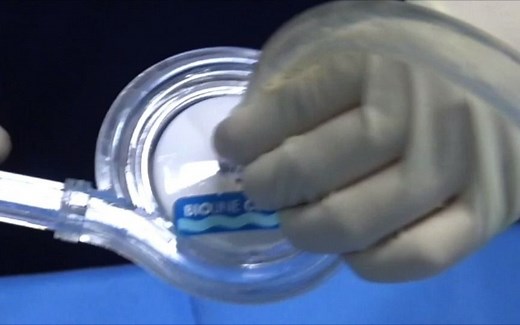 ECMO系统安装及预充