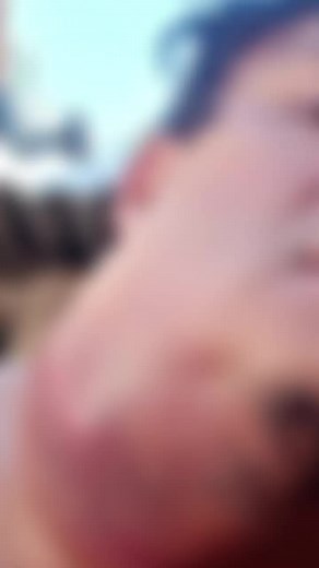 Identifying and Treating Skin Irritation Symptoms