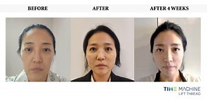 Timemachine Lift Thread Launches Two New Molding Lifting Threads