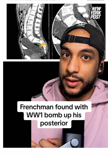 The French need to be studied | french men