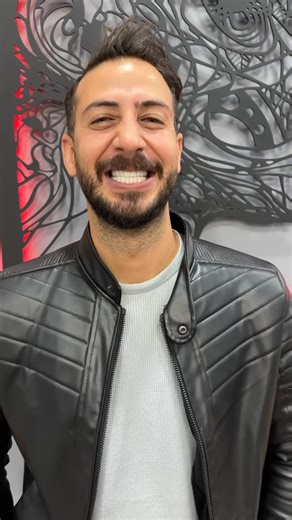 Clinic Lina on Instagram: "🦷 Tedavi: Gülüş tasarımı ⏱ Süre: 4-7 gün 👍🏻 Ağrısız 🦷 Treatment: Smile design ⏱ Duration: 4-7 days 👍🏻 Painless #zirkonyumdiş #estetikdiş #laminediş #lamine #gülüştasarımı gülüşestetiği hoolywoodsmile porselendiş dişhekimi dişbeyazlatma zirkonyumköprü köprüdiş porselenköprü dişhekimi dişteli zirconia zirconiacrown smiledesign eastheticdentistry laminate laminateveneer porselaincrown dentistry bleaching teethwhitening dentalbraces smilemakeover implant implantdiş i