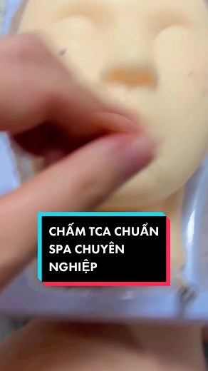 Cách chấm TCA tàn nhang chuẩn tại Spa chuyên nghiệp