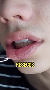 Como Curar Labios Resecos #labios #labiosperfectos #skincare #cuidadopersonal #belleza | PerfectoRostro