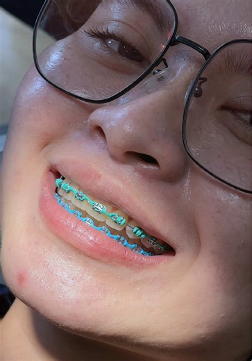 Cute Smiles at Bright Smile Dental Hospital