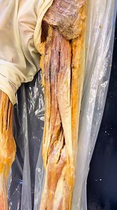 Now You Know: The three muscles in your #hamstrings ✔️ Follow for more #anatomicalawesomeness🧠 Institute of Human Anatomy | Institute of Human Anatomy