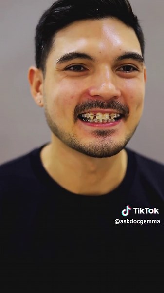 Josh Colet's Anodontia Progress Journey: From Missing Tooth to Confident Smile