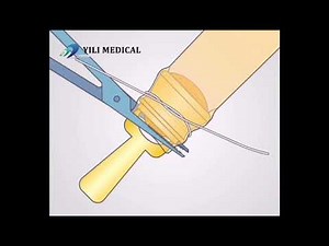 Disposable medical EasyThru Children Circumcision Device