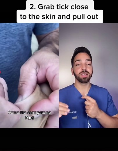 #duet with @andryellytavares1 tick-tok #dermdoctor #ticktok #dermatologist #skincare #learnontiktok #tiktokpartner