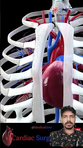 Open Heart 🫀 Surgery | Rib Cage Anatomy | Cardiac Sinus Explained | #medical #heart #anatomy#surgery