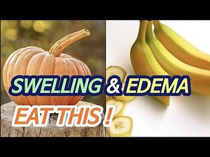 5 Foods good for swelling, edema