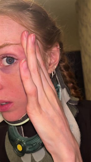 Starting My Surgical Training in Craniocervical Instability