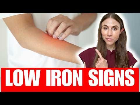 Iron Deficiency Signs Your Skin, Hair & Nails Are Trying To Warn You About