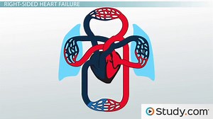 Heart Failure: The Right Heart, Kidneys, & Treatments