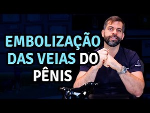 Penile Vein Embolization | Dr. Marco Túlio Cavalcanti
