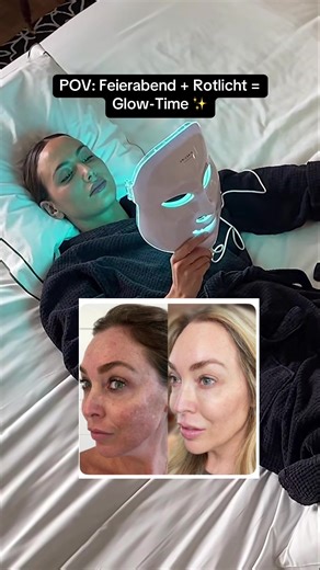 Hol dir dein Glow Ritual für eine straffe und Strahlende Haut Link in Bio