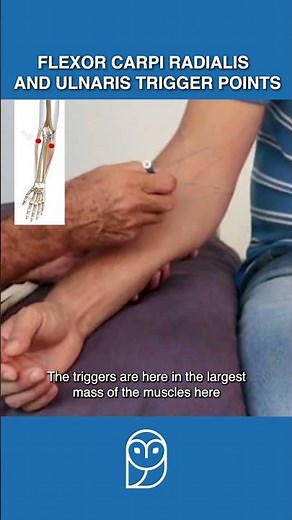 Is Your Wrist Pain Caused By Trigger Points In the Forearm Flexors?