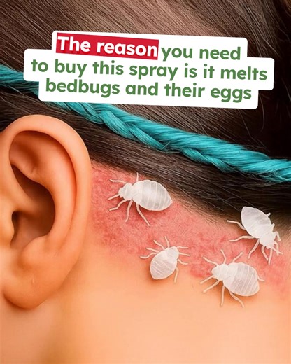 "BugMD is a game-changer! ⭐⭐⭐⭐⭐ It delivers on its promise to kill bugs instantly. My bed bug problem is finally under control after trying everything else. I’m thrilled after spending over $4K on exterminator and other solutions!" – Sheri C. Thousands of Americans trust BugMD’s revolutionary Essential Pest Control to eliminate bedbugs effectively and safely, when used as directed. ✅ Plant-powered formula ✅ Kills 40 pests by contact ✅ Family and pet-friendly ✅ Easy to use ✅ Affordable ✅ 1000’s o