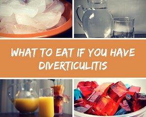 Foods You Can or Can't Eat When You Have Diverticulitis