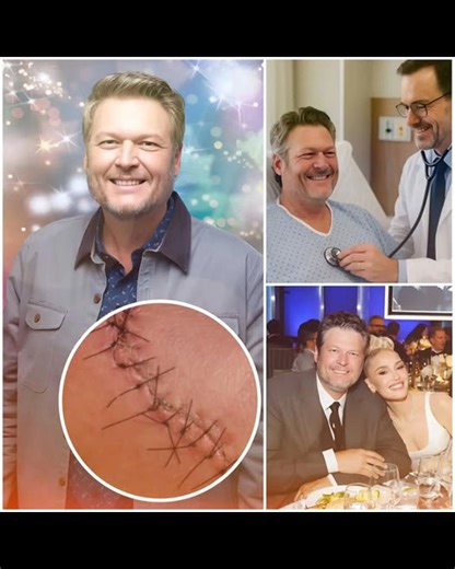 "✨ UPDATE: BLAKE SHELTON SHARES HIS FIRST WORDS AFTER SURGERY — AND IT’S A MESSAGE OF HOPE AND HEART. ❤️ After weeks of silence that left fans concerned, Blake Shelton has finally spoken out — and his words have touched millions. https://kry.feji.io/blog/update-blake-shelton-shares-his-first-words-after-surgery-and-its-a-message-of-hope-and-heart “I know the road ahead won’t be easy, but I’m staying positive. Healing comes through love, music, and the support of those around me.” The surgery is 
