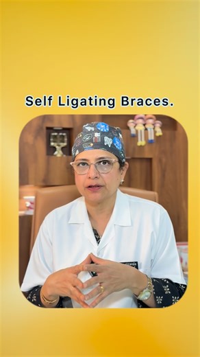 Sakina Ginwala | Type 2:- Self-Ligating Braces are modern orthodontic appliances that use specially designed brackets with built-in clips or doors to hold... | Instagram