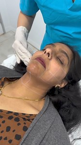Did you know we offer medical grade Laser Hair Removal for the face and body? We offer targeted areas for treatment including the upper lip, chin, cheeks and nose. Ready to start your hair free journey to smooth skin everyday? Book in a FREE consultation and get started, you won’t look back 👉 bit.ly/3PSC0Oj | Australian Skin Clinics