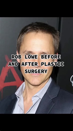 Rob Lowe: Celebrity Facts and Plastic Surgery Rumors