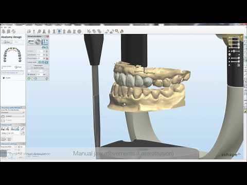 Dental System™ 2010 - Dynamic Virtual Articulation