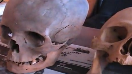 Black market in elongated skulls of Peru