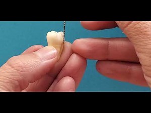 Periodontal Probing Adaptation