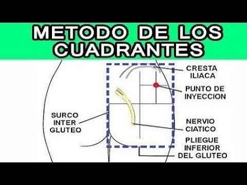 🔴 INYECTOTERAPIA METODO DE LOS CUADRANTES (VIA INTRAMUSCULAR) - 2021