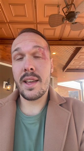 Brandon White on Reels