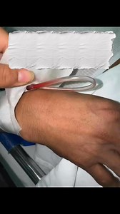 438K views · 946 reactions | Mala fijación, pésimas uñas y el fomite que no falte  #viralvideoシ #enfermeria | Profe. Marco | Facebook