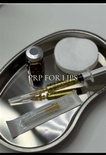 My hack for girls who’ve had overfilled lips 💋 If you want to go back to basics PRP helps improve lip tissue, hydration, and definition — making lips look sharper, healthier, and subtly fuller, especially in between dissolving or filler breaks. It will help prevent future migration by giving back natural support. #fyf #lipfiller #lipfillerdissolve #dissolve #prp