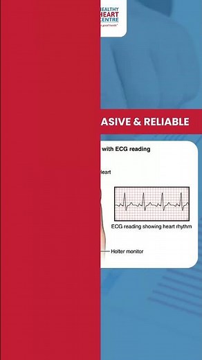 Stay Heart Smart with Holter Monitoring ❤️📊 #healthyheartcentre
