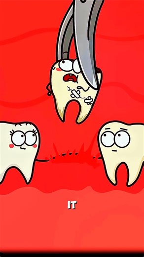 Did You Know Not All Wisdom Teeth Are Bad? 😲🦷 #animation